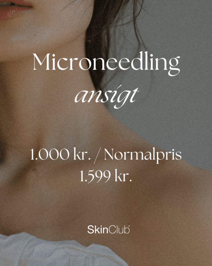PRF microneedling Kolding København SkinClub Kosmetisk klinik