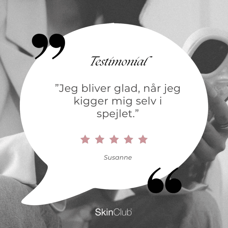 Kundeudtalelse SkinClub Düwald Kolding København