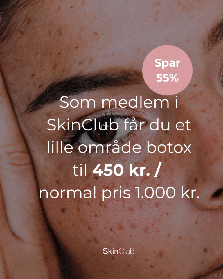 Botox Kolding København SkinClub
