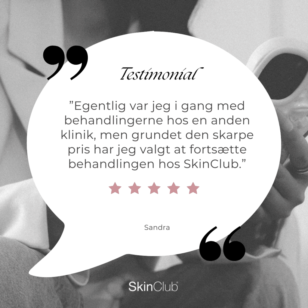 Kundeudtalelse SkinClub Düwald Kolding København
