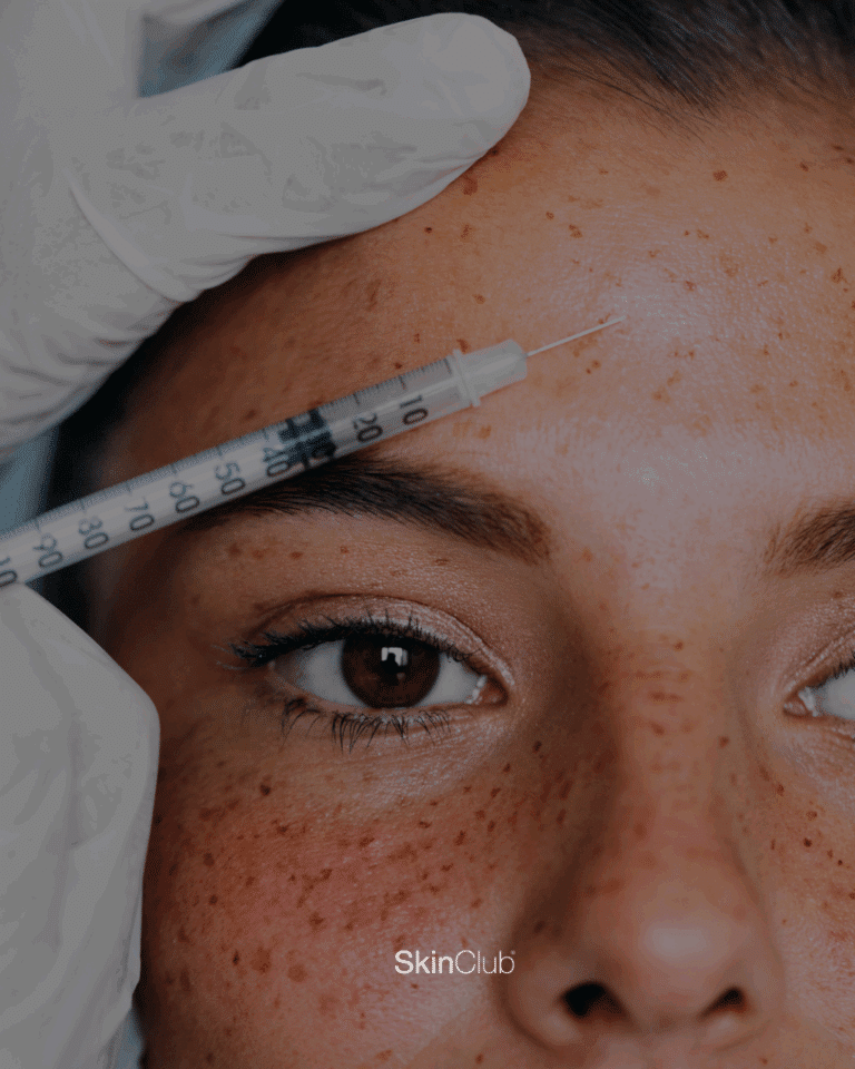 SkinClub kosmetisk klinik Kolding København rynkereduktion