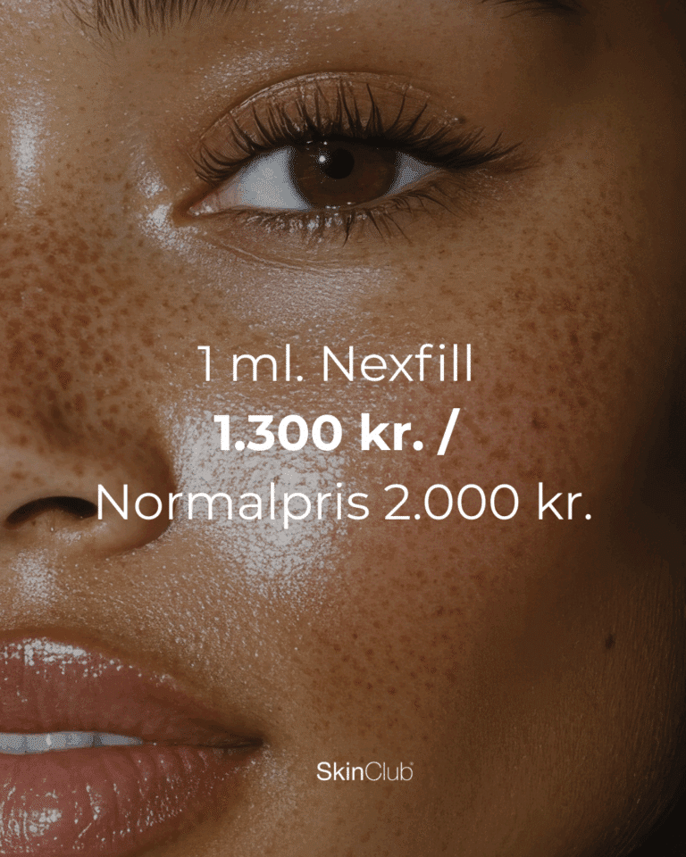 Botox Fillers Kolding København SkinClub